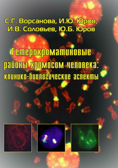 Гетерохроматиновые районы хромосом человека