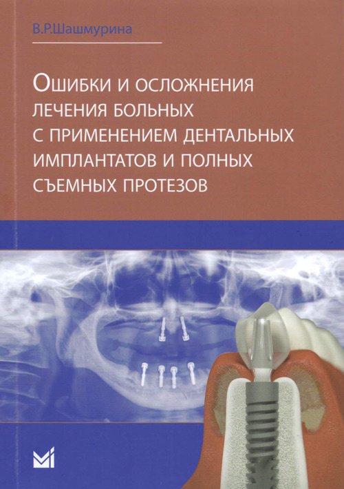 Ошибки и осложнения лечения больных с применением дентальных имплантов и полных съемных протезов