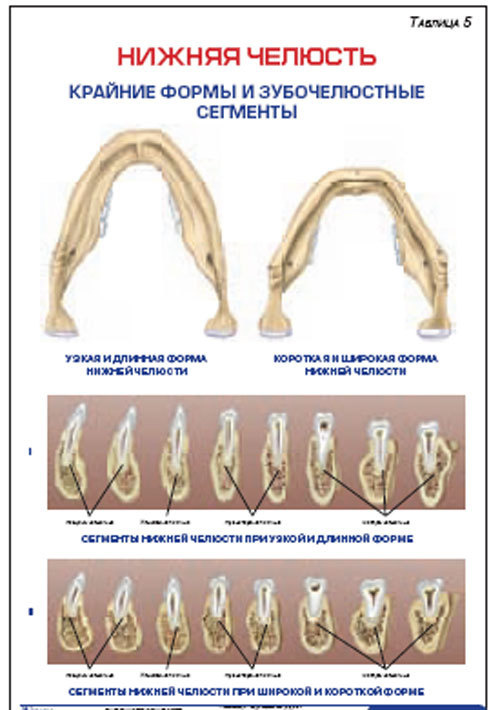Плакат &#8220;Нижняя челюсть. Крайние формы и зубочелюстные сегменты&#8221; (800*1100)