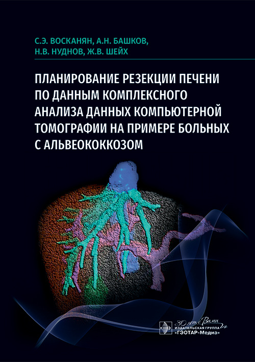 Планирование резекции печени по данным комплексного анализа данных компьютерной томографии на примере больных с альвеококкозом