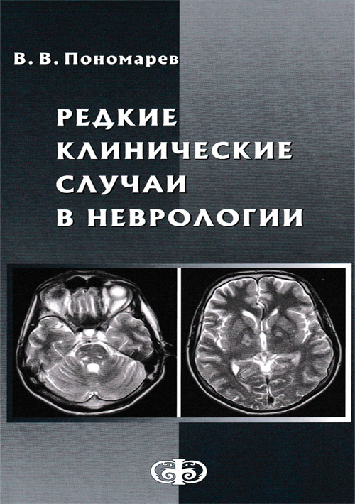 Редкие клинические случаи в неврологии. Случаи из практики. Руководство