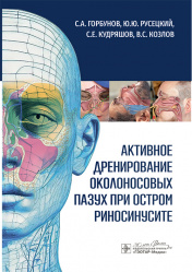 Активное дренирование околоносовых пазух при остром риносинусите