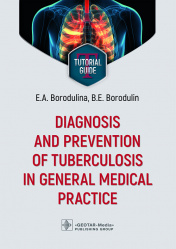 Diagnosis and prevention of tuberculosis in general medical practice. Tutorial guide