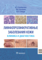 Лимфопролиферативные заболевания кожи. Клиника и диагностика (уценка 40)