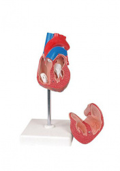 Модель гипертрофии сердца, 2 части, на подставке