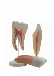 Модели зубов моляра и резца. 2 части. Комплект