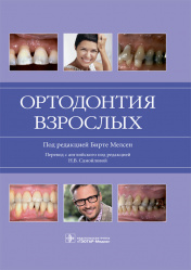 Ортодонтия взрослых