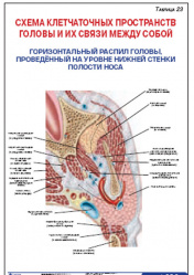 Плакат &#8220;Схема клетчаточных пространств головы и их связи между собой. Горизонтальный распил головы, проведенный на уровне нижней стенки полости носа&#8221;