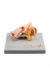 Заболевания уха. Модель из 4-х частей на подставке. Увеличение в 1,5 раза