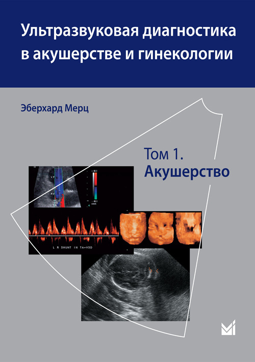 Ультразвуковая диагностика в акушерстве и гинекологии в 2-х томах. Том 1